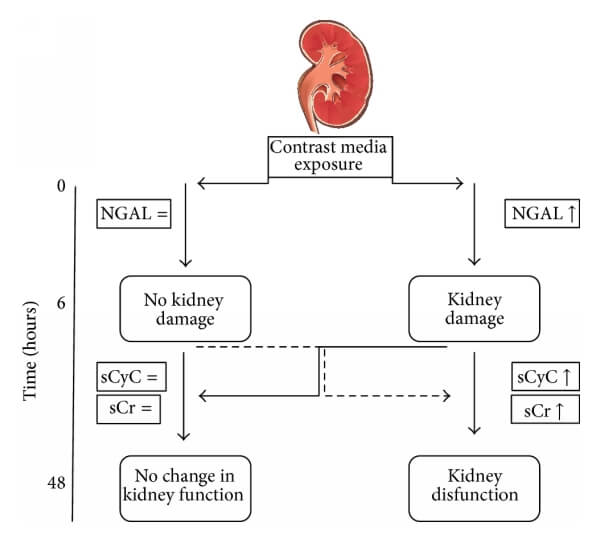 CysC與NGAL、Cr的關(guān)系