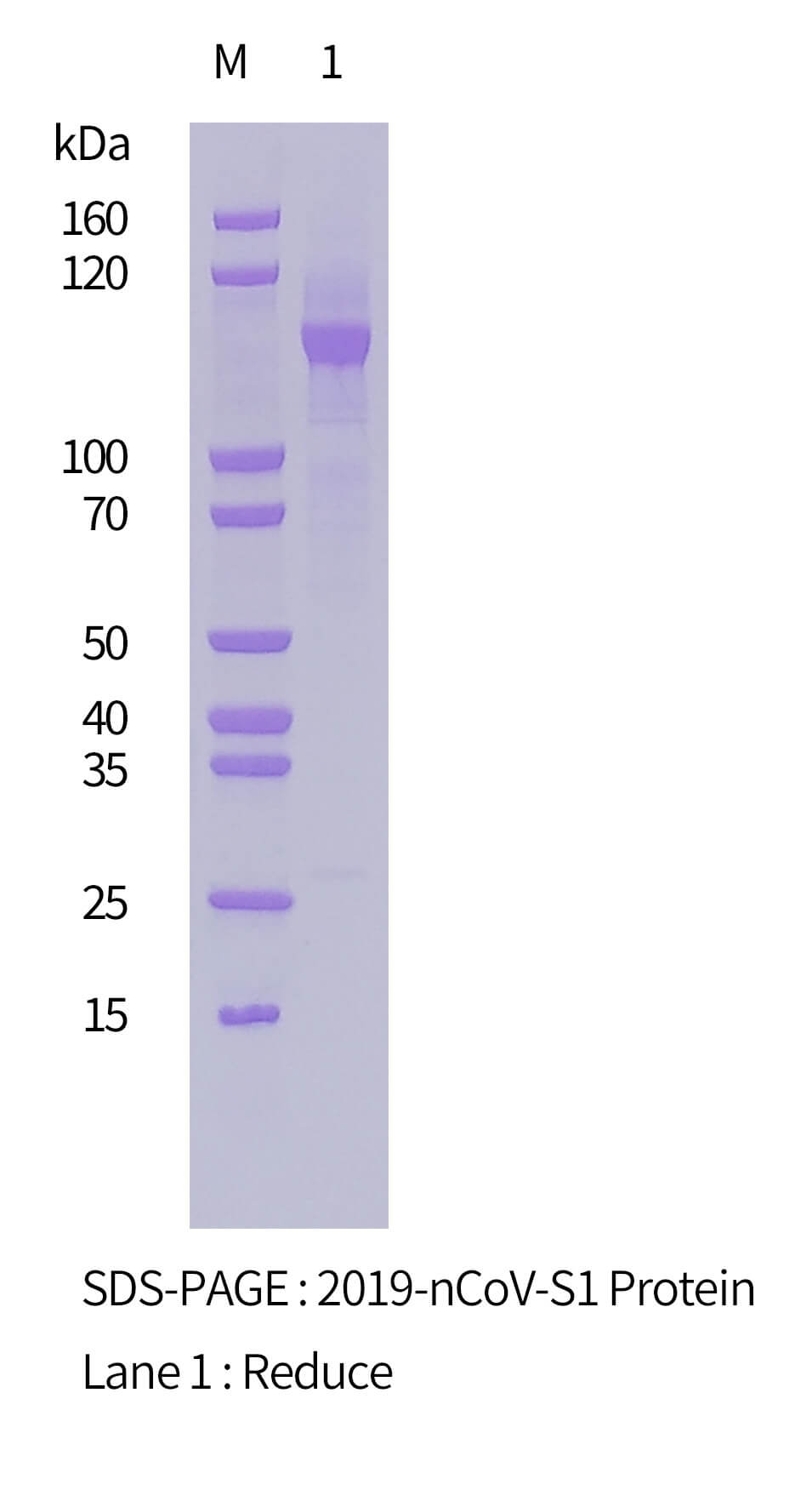 S1蛋白SDS-PAGE圖